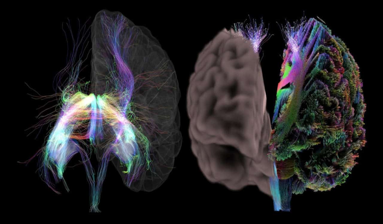 AI system creates synthetic brain scans