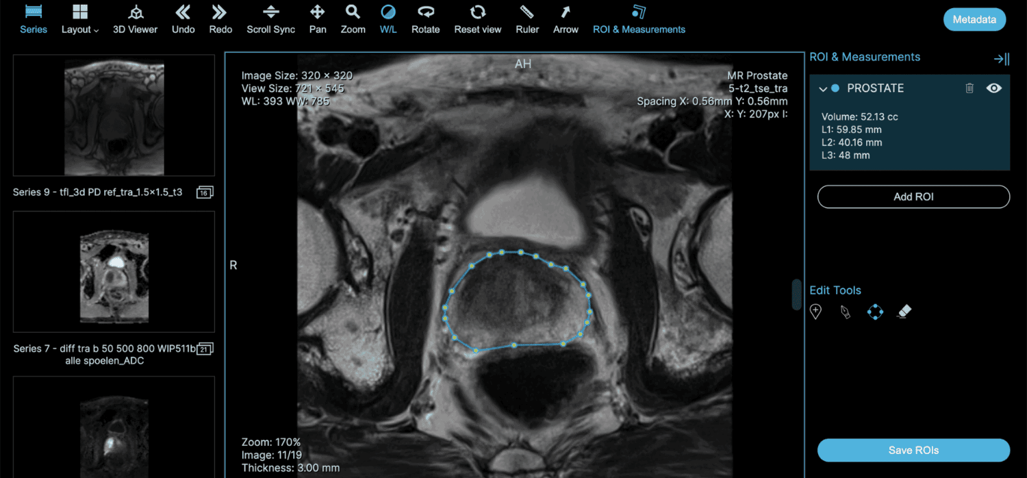 AI analyzes medical scans for in-depth results